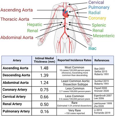 Arterial dissections: Common features and new perspectives